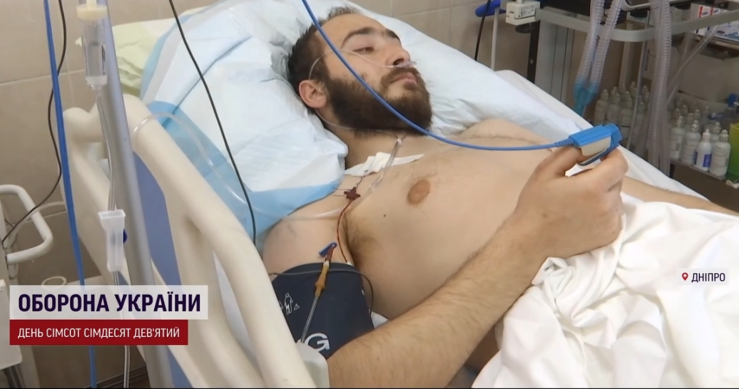 Дістав одразу два поранення і втратив кінцівку: щемлива історія порятунку захисника України